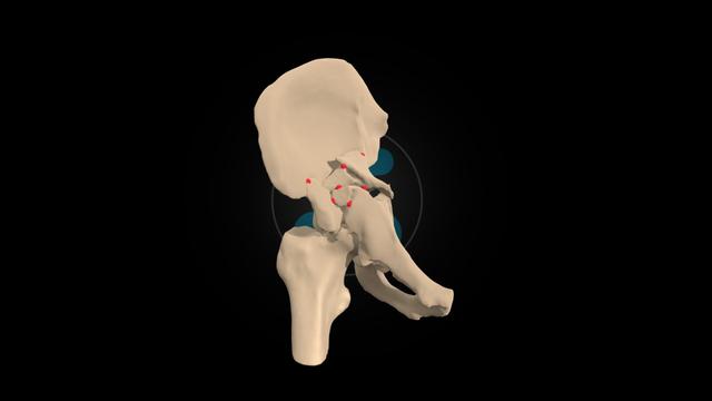 HumanX Medical Case Study #004 3D model thumbnail