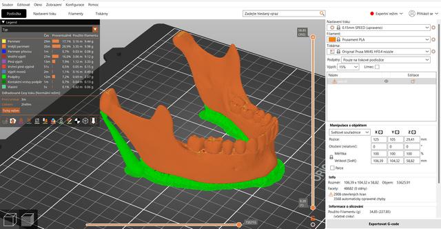 Anatomacally correct human jaw 3D model thumbnail